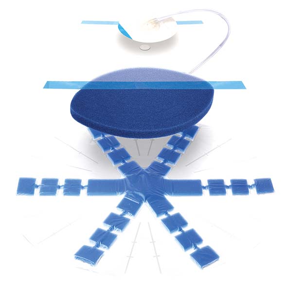 Abthera sårbehandling sensa trac